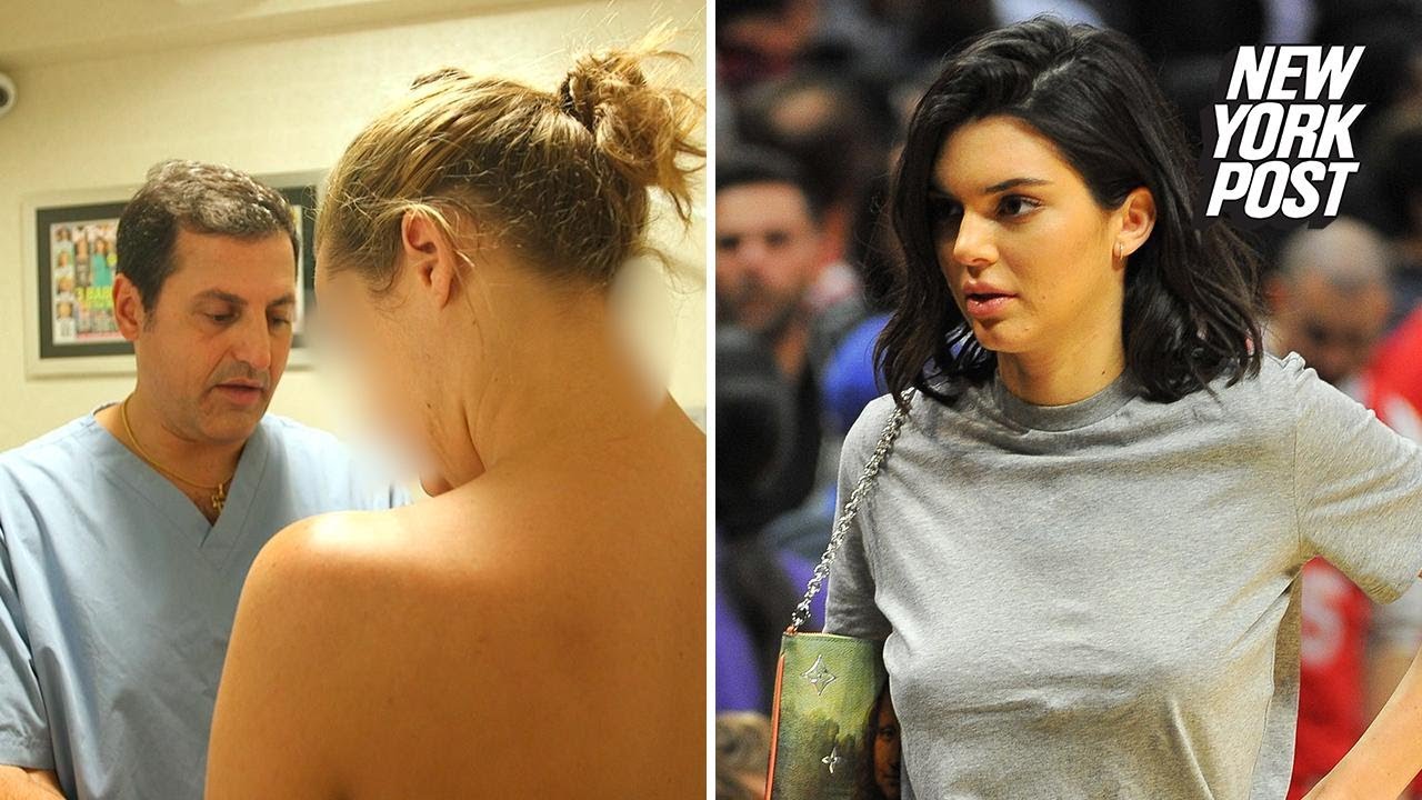 NOVI TREND Dizajnerske bradavice, jer žene žele izgledati poput Kendall Jenner